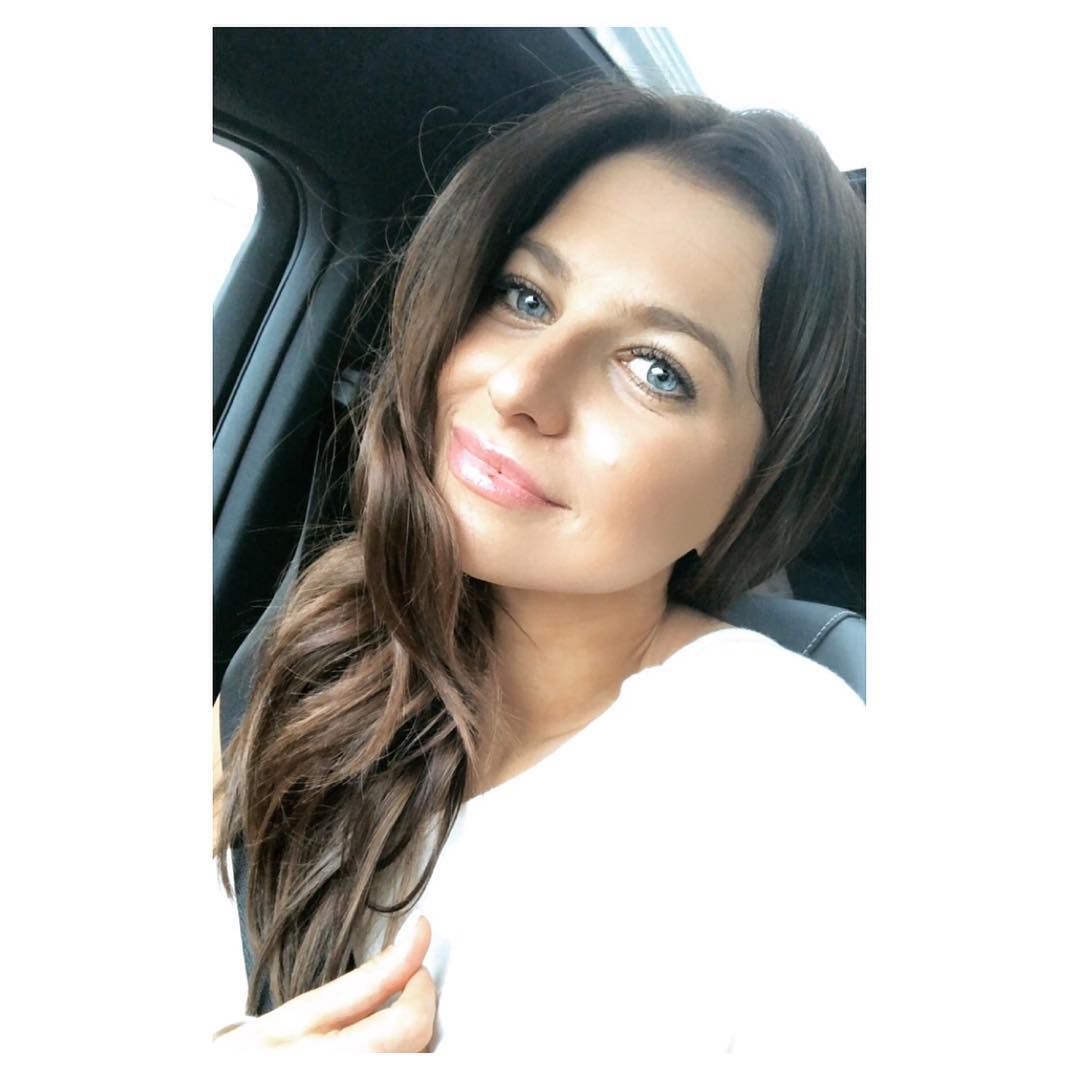 Anna Lewandowska powiększyła usta?