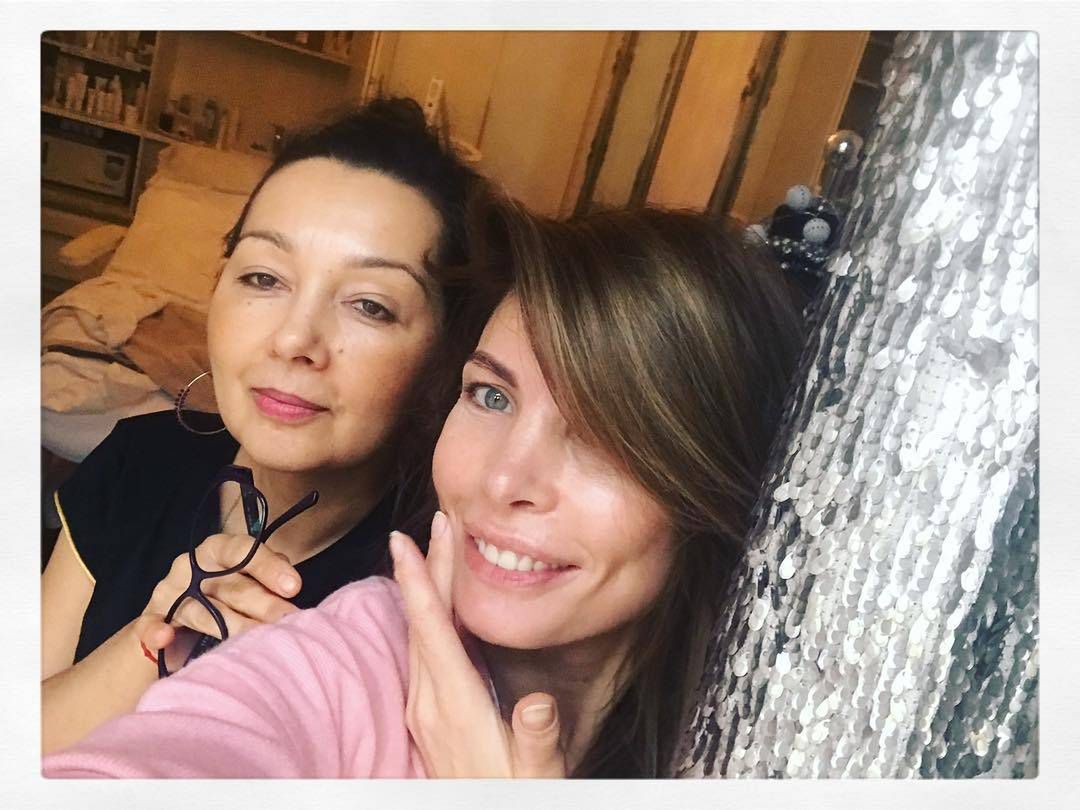 Agnieszka Dygant komentuje swoja metamorfozę, czy zastosowała botoks?