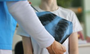 Nauczycielka z gruźlicą w mrągowskiej szkole. Do diagnozy m.in. uczniowie