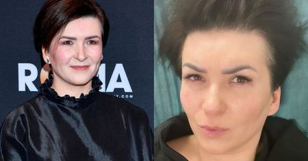 Katarzyna Łaska zaliczyła upadek na scenie. W szpitalu przeżyła chwile grozy: "Spędziłam DZIEWIĘĆ godzin na SOR-ze"