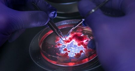 HIV może ukrywać się w komórkach mózgowych, które są w stanie zarazić inne narządy