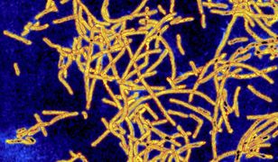 Bakterie legionelli w szpitalu. Odkryto je przypadkiem