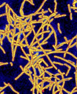 Bakterie legionelli w szpitalu. Odkryto je przypadkiem