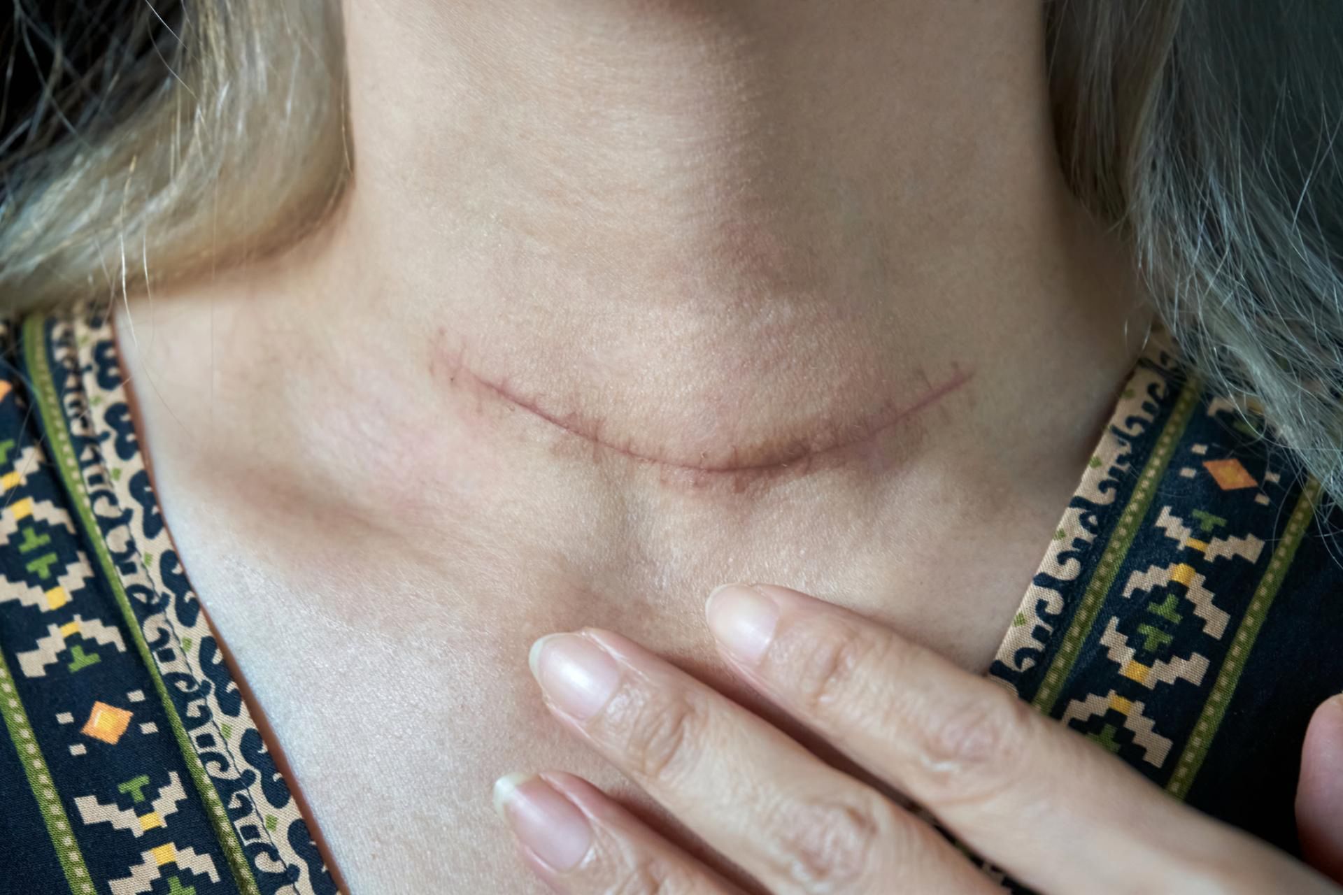 Ponad 20 proc. Polaków zmaga się z chorobami tarczycy