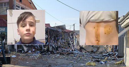 Bawił się z kolegami. Nagle nadleciał rosyjski dron. Pokazał siniaki