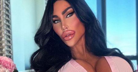 Niewiarygodne, jak "australijska Barbie" wyglądała przed operacjami plastycznymi. Wydała na nie fortunę