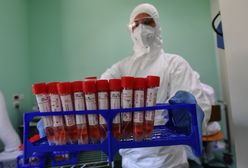 Pochodzenie koronawirusa. Najnowsze badania zaskakują. Teraz wszyscy uznają, że wydostał się z laboratorium?