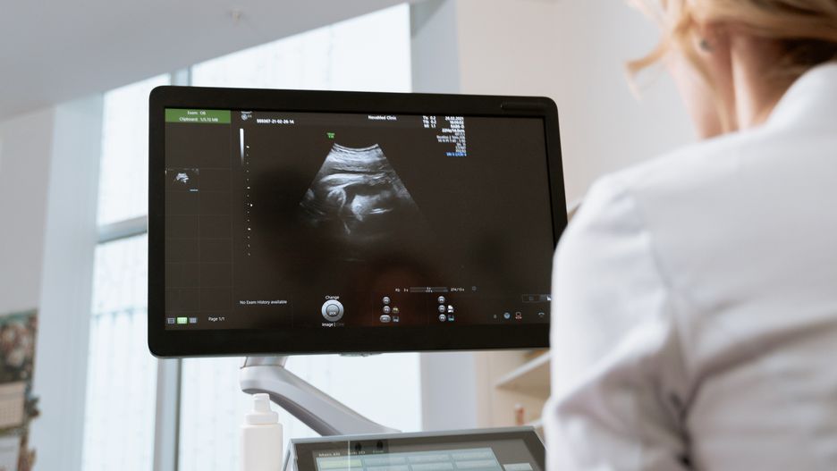 W Karolinie Południowej aborcja jest legalna do 6 tygodnia