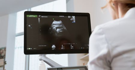 Kara śmierci za aborcję? Republikanie chcą zmiany prawa