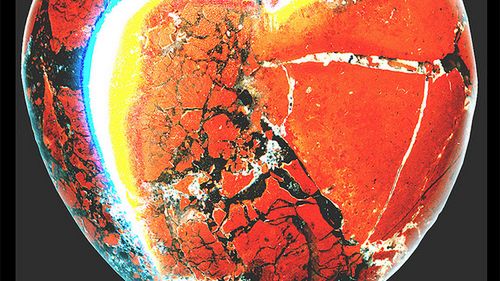 Hydrożel na serce 1