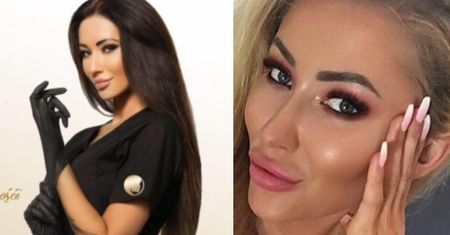 Uczestniczka "Top Model" oszpeciła swoją klientkę? "Czeka mnie długie i bolesne leczenie"