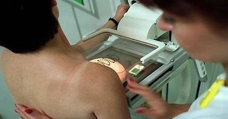 Feministki zablokowały projekt obowiązkowej mammografii i cytologii
