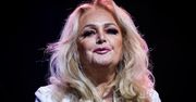 Bonnie Tyler trafiła do szpitala. Pilna operacja gwiazdy