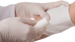 Rodzaje opatrunków. Zobacz, czym charakteryzuje się opatrunek osłaniający