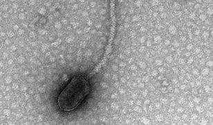 Naukowcy sugerują, że wirusy mogą nas "obserwować" i czekać na dogodną okazję do ataku