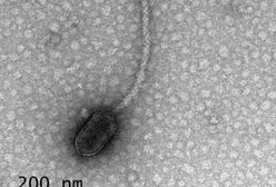 Naukowcy sugerują, że wirusy mogą nas "obserwować" i czekać na dogodną okazję do ataku
