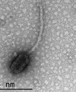 Naukowcy sugerują, że wirusy mogą nas "obserwować" i czekać na dogodną okazję do ataku