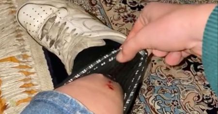 TikTokerka poczuła silny ból. Gdy spojrzała w dół, zaczęła krzyczeć z przerażenia