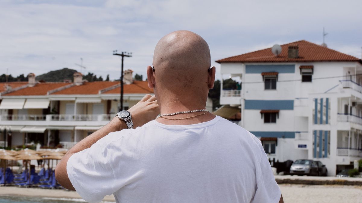 Łysi mężczyźni są bardziej podatni na śmierć z powodu koronawirusa