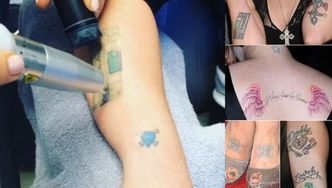 Kelly Osbourne usuwa tatuaże!