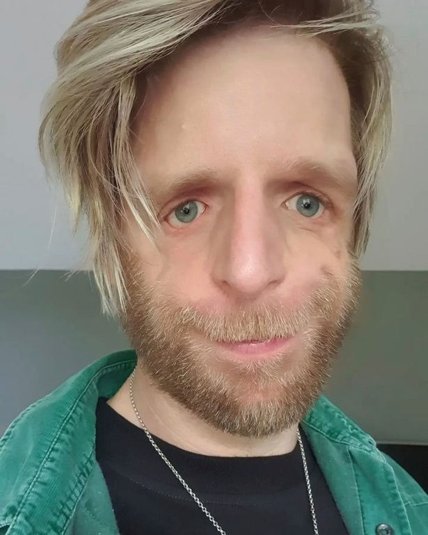 Jono dopiero na studiach zaakceptował swój wygląd