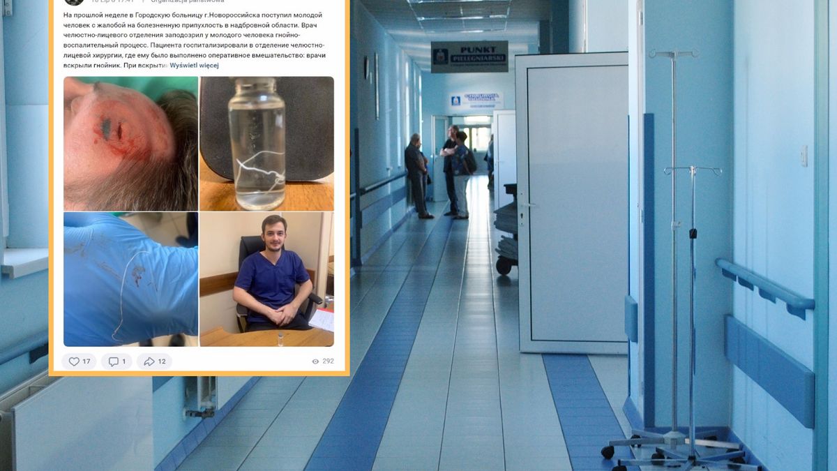 Obrzydliwe! Znaleźli to w jego czole.(Autor: GBUZ "GB No. 1 of Novorossiysk" MZ KK / VK.com /)