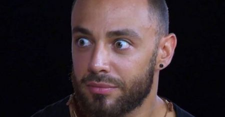 Krystian z "Hotelu Paradise" żali się na NIEUDANY BOTOKS! "Broda poszła do dołu, ale TYLKO Z JEDNEJ STRONY" (FOTO)