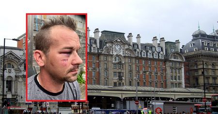 Zapytał nieznajomych o drogę. Polak brutalnie pobity w Londynie