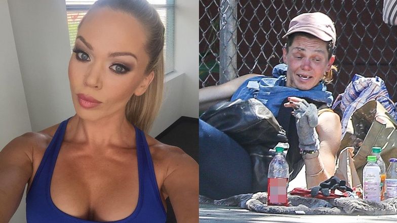 Loni Willison straciła zęby