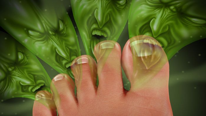 Sprawdź, jak poradzić sobie z potliwością stóp