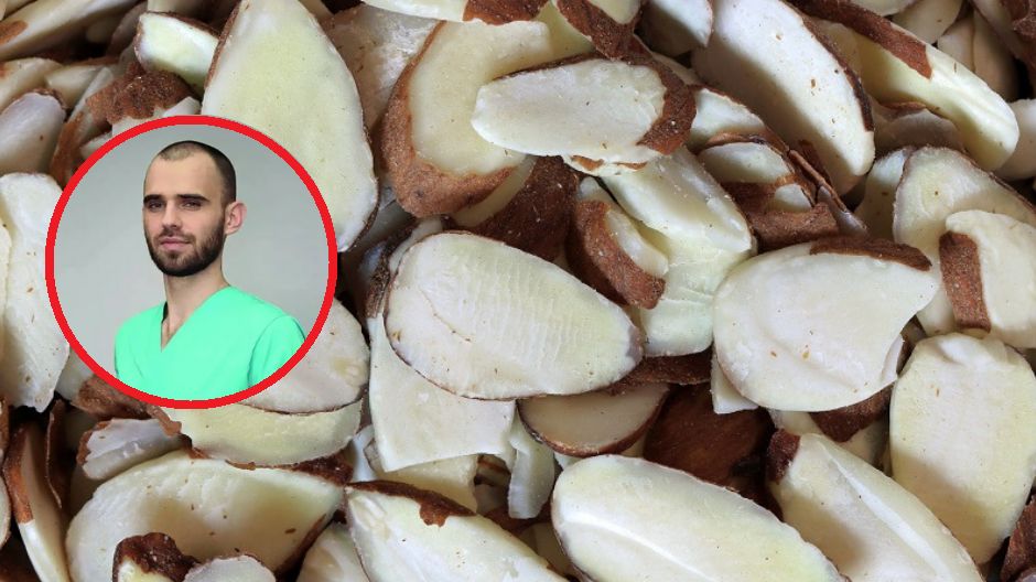 Dlaczego warto jeść orzechy?