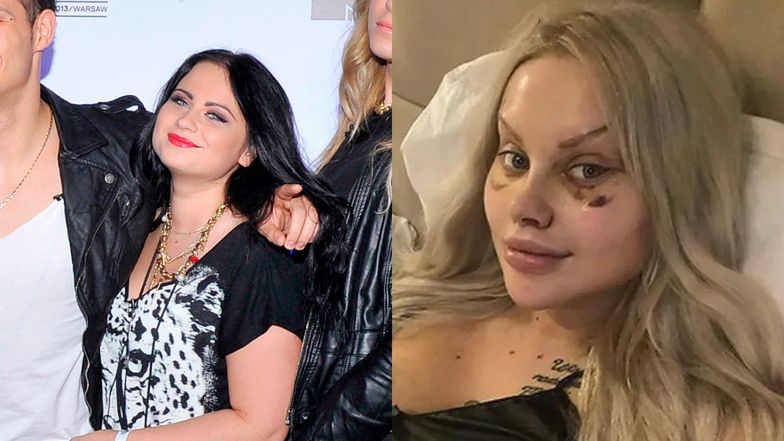 Te gwiazdy pożałowały operacji plastycznych