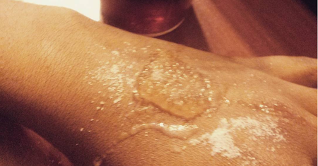 Salt and ice challenge: niebezpieczna zabawa nastolatków
