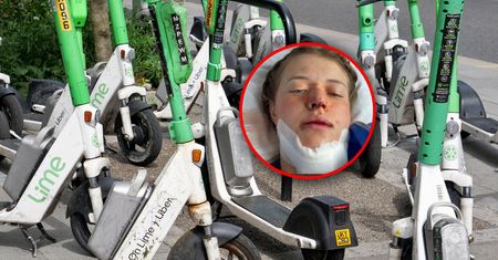 "To był koszmar". Tak wygląda jej życie po wypadku na hulajnodze