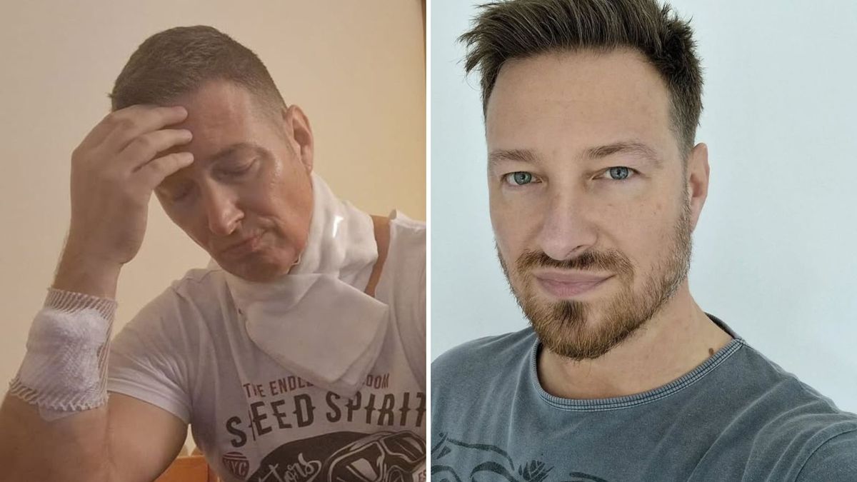 Maciej Jachowski o walce z nowotworem gardła