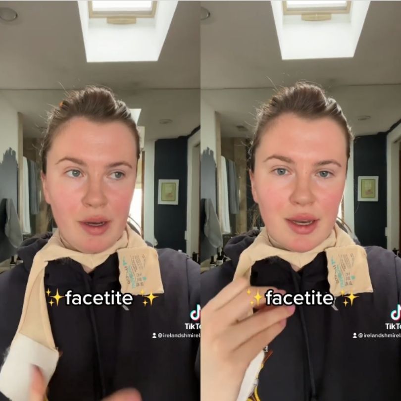 Ireland Baldwin tłumaczy się z zabiegu podbródka