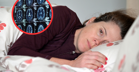 Demencja zaczyna się od serca. Kluczowe są decyzje w średnim wieku