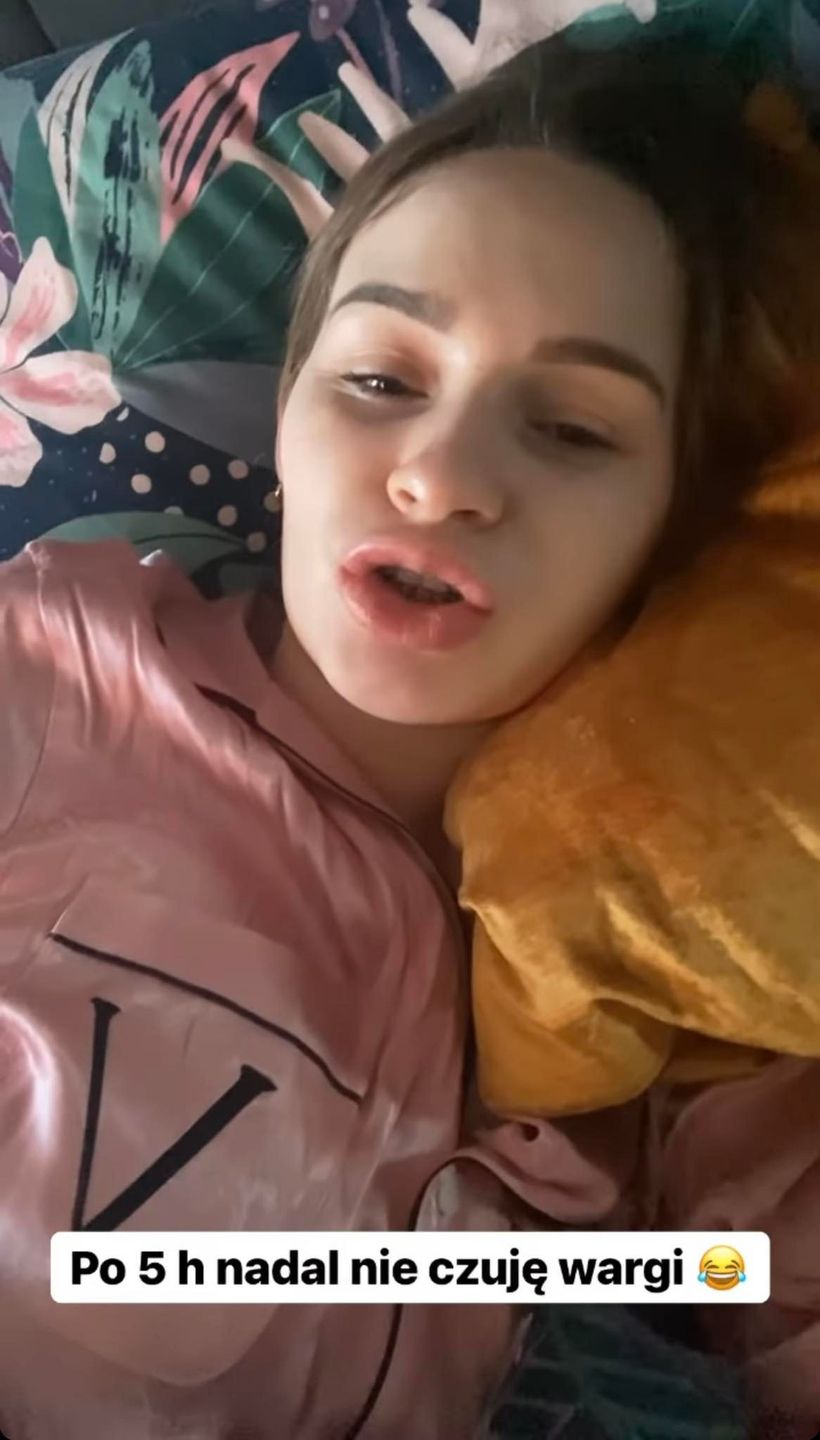 Ewelina Lisowska prezentuje, jak wygląda po zabiegu u dentysty