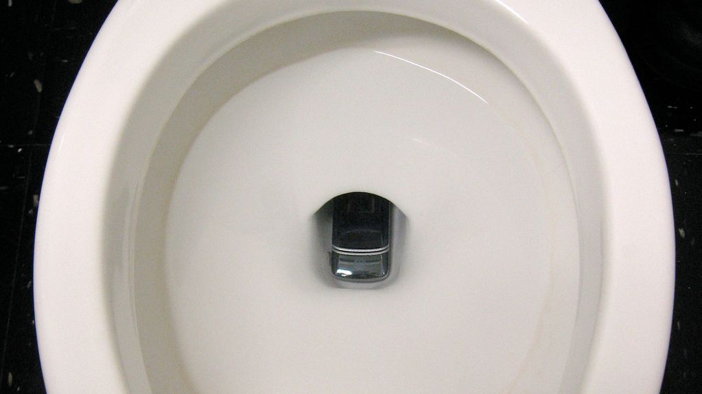 TOP10 najbrzydszych komórek na świecie 1