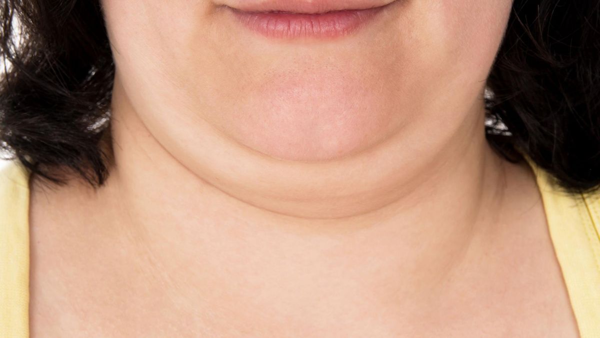 Drugi podbródek jest częsty u osób z nadwagą [123rf.com]