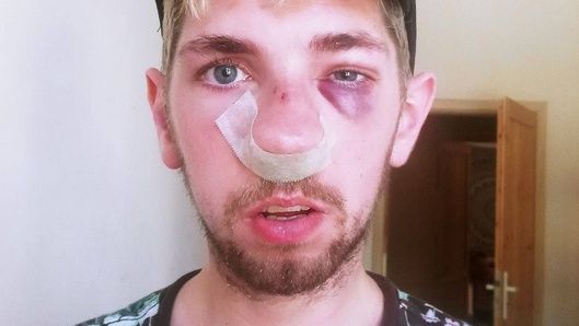 homofobia lgbt pobicie