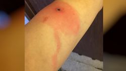 Pierwsza ofiara śmiertelna wirusa Alaskapox. Mężczyzna opiekował się bezpańskim kotem