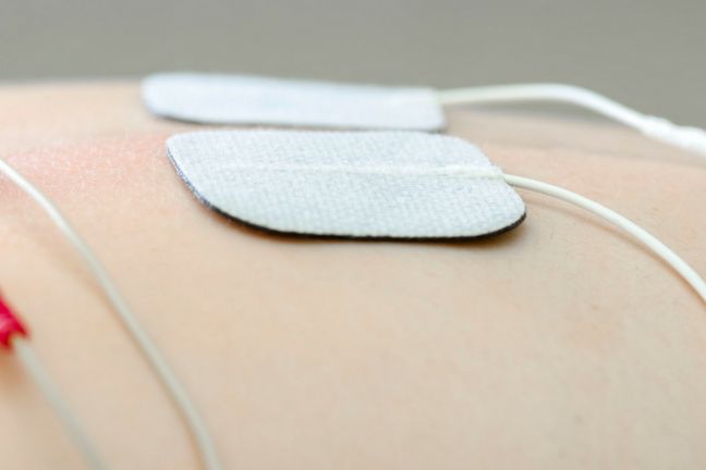 TENS to metoda obecna również na polskich salach porodowych 