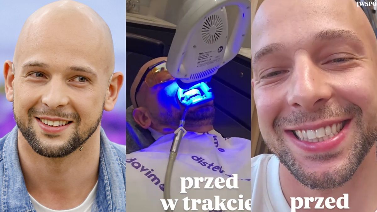 Maciej Pela pochwalił się nowym uzębieniem