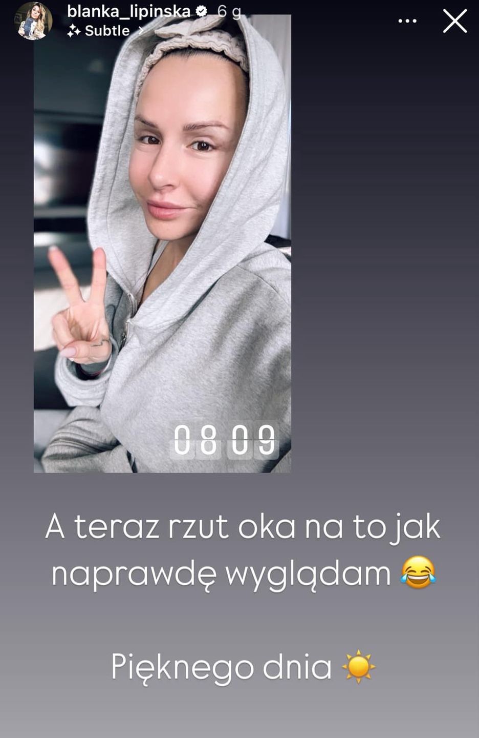 Blanka Lipińska pokazała się po liftingu twarzy