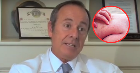 Obrzęk nóg może wskazywać na zakrzepicę. Konieczna jest szybka diagnoza