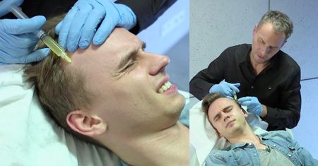 Zabieg ostrzykiwania osoczem w "Dzień Dobry TVN": Pobierają krew i wstrzykują osocze w czoło...