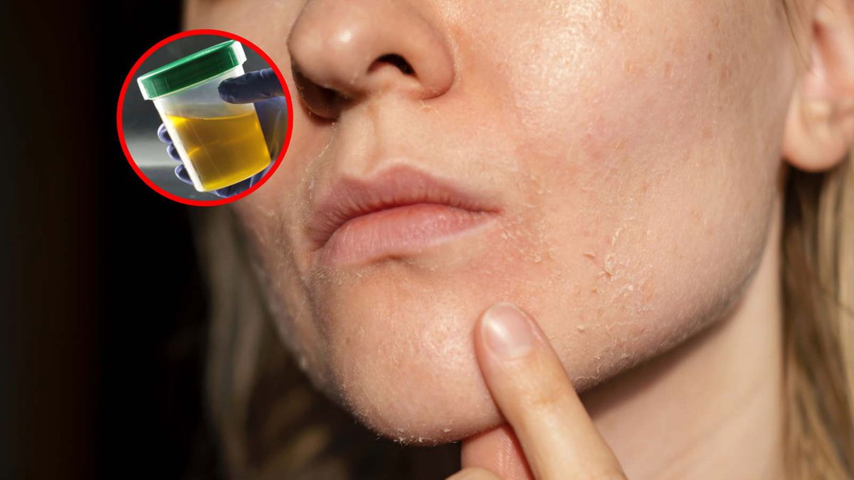 Przetestowała nietypowy sposób na suchą skórę. Dawna praktyka nie zdała egzaminu