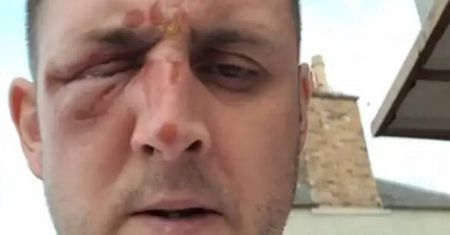 To może być nauczka dla innych. Jajko eksplodowało mu w twarz