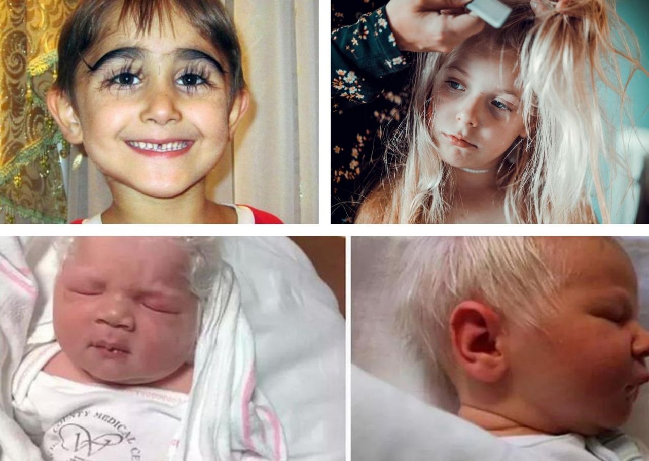 Białe lub siwe włosy u malucha. Niezwykłe dzieci mogą mieć poważny problem